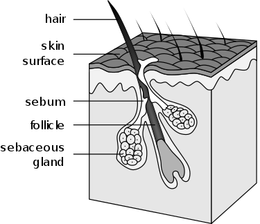 Pore reduction method The reason why pores get bigger