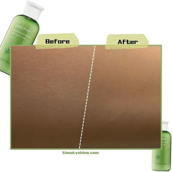 Innisfree Balancing Emulsion Review  Oil skin 2. Before & After