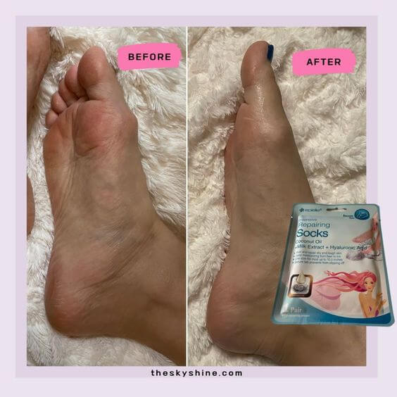 Epielle Intensive Repairing Socks Review 1. Before & After