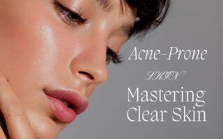 Mastering Clear Skin: Your Ultimate Guide to Acne-Prone Skincare