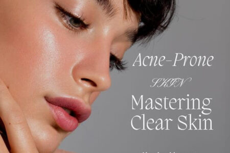 Mastering Clear Skin: Your Ultimate Guide to Acne-Prone Skincare