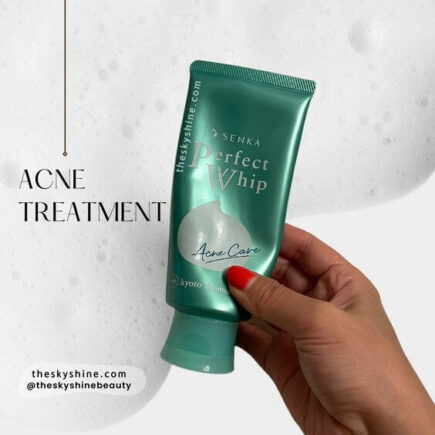 Senka Perfect Whip Acne Care Review: For Clear Skin Seekers